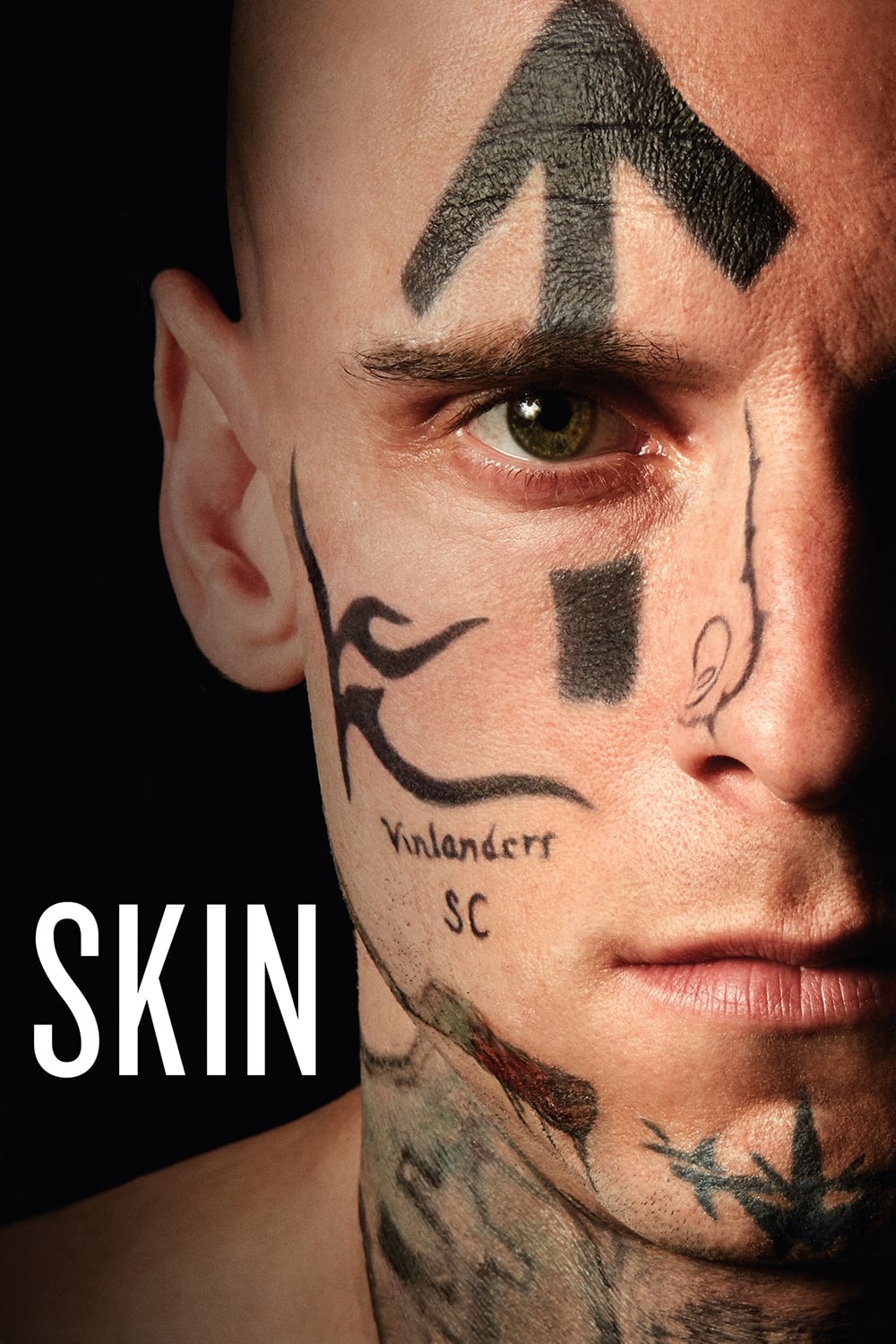  Skin 